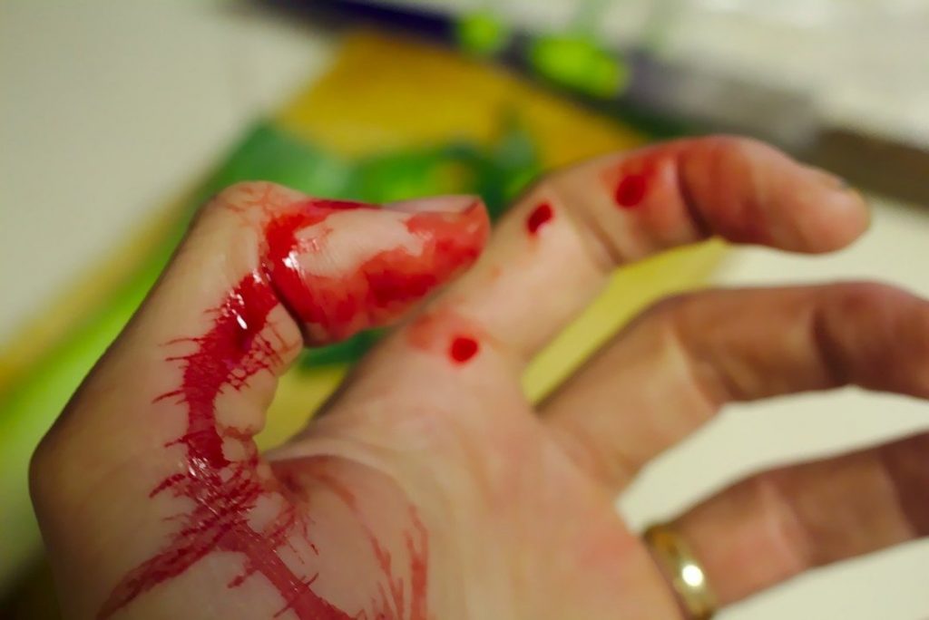 accident